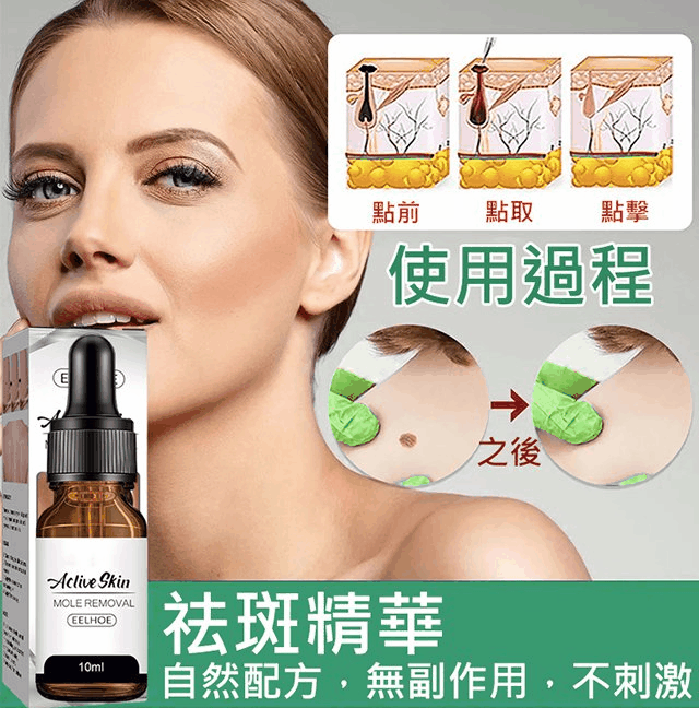 點痣克疣精華液